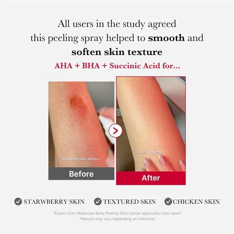 RedAcneBodyPeelingShot_110g_5