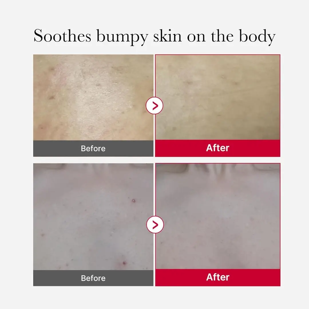 medicube-red-acne-body-peeling-shot_8800240576233_DarBeauty_05
